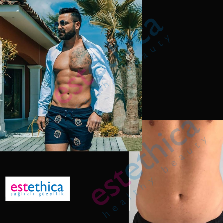 Six-Packs---M